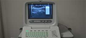 Real-time Ultrasound Imaging